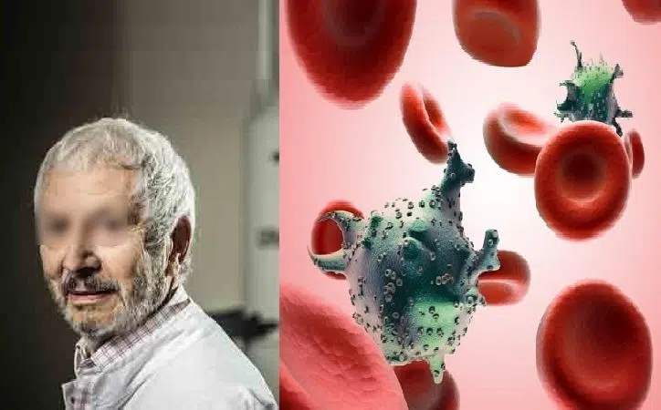 Un chercheur trouve un potentiel remède contre le sida
